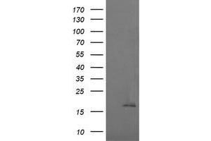 Image no. 1 for anti-Cancer/testis Antigen 1B (CTAG1B) antibody (ABIN1499901) (CTAG1B 抗体)