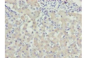 Immunohistochemistry of paraffin-embedded human liver tissue using ABIN7175806 at dilution of 1:100 (WDR91 抗体  (AA 1-747))