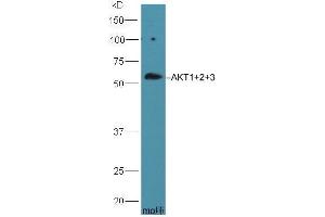 anti-AKT 1/2/3 (AA 401-480) antibody