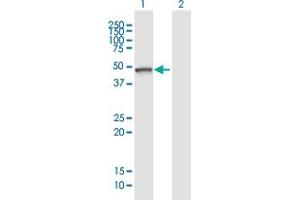 Western Blot analysis of TLE6 expression in transfected 293T cell line ( H00079816-T01 ) by TLE6 MaxPab polyclonal antibody. (TLE6 抗体  (AA 1-449))