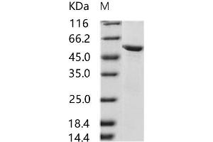 Western Blotting (WB) image for HIV-2 gp36 protein (His tag,MBP tag) (ABIN7196112) (HIV-2 gp36 protein (His tag,MBP tag))