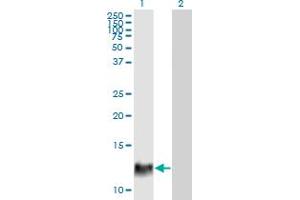 Western Blot analysis of HBXIP expression in transfected 293T cell line by HBXIP monoclonal antibody (M12), clone 4G1. (HBXIP 抗体  (AA 83-173))