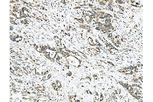 IHC analysis of Ezrin/EZR using anti-Ezrin/EZR antibody (ABIN7603214). (Ezrin 抗体  (N-Term))