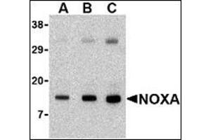 Western blot analysis of Noxa in human stomach tissue lysate with this product at (A) 0. (NOXA 抗体  (N-Term))