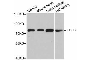 Western blot analysis of extracts of various cell lines, using TGFBI antibody (ABIN5971386) at 1/1000 dilution. (TGFBI 抗体)