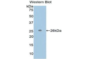 Western Blotting (WB) image for anti-L1 Cell Adhesion Molecule (L1CAM) (AA 218-423) antibody (ABIN1173993) (L1CAM 抗体  (AA 218-423))