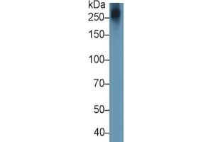 Mouse Capture antibody from the kit in WB with Positive Control:  Human Lymphocyte lysate. (Aggrecan ELISA 试剂盒)