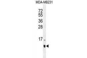 Western Blotting (WB) image for anti-Host Cell Factor C1 Regulator 1 (XPO1 Dependent) (HCFC1R1) antibody (ABIN2996292) (HCFC1R1 抗体)