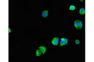 Immunofluorescent analysis of MCF-7 cells using ABIN7147419 at dilution of 1:100 and Alexa Fluor 488-congugated AffiniPure Goat Anti-Rabbit IgG(H+L) (CEP7 (AA 99-276) 抗体)