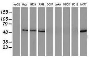 Image no. 2 for anti-Sequestosome 1 (SQSTM1) antibody (ABIN1499991) (SQSTM1 抗体)