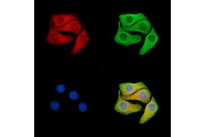 ABIN7096340 and ABIN7100402 staining Hela cells by IF/ICC.