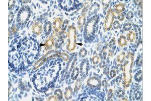 Image no. 1 for anti-Interferon Regulatory Factor 8 (IRF8) (AA 35-84) antibody (ABIN202494) (IRF8 抗体  (AA 35-84))