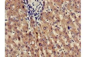 Immunohistochemistry of paraffin-embedded human liver tissue using ABIN7165664 at dilution of 1:100 (JAG1 抗体  (AA 809-1046))
