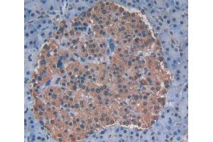 Used in DAB staining on fromalin fixed paraffin- embedded pancreas tissue (ABCF2 抗体  (AA 396-623))