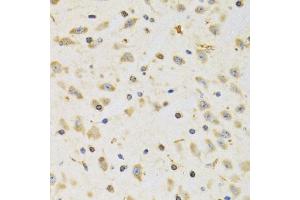 Immunohistochemistry of paraffin-embedded rat brain using RPS12 antibody (ABIN1980257) at dilution of 1:100 (40x lens). (RPS12 抗体)