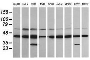 Image no. 1 for anti-Mitogen-Activated Protein Kinase Kinase 1 (MAP2K1) antibody (ABIN1499395) (MEK1 抗体)