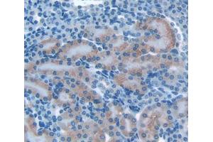 Used in DAB staining on fromalin fixed paraffin- embedded kidney tissue (OS9 抗体  (AA 471-672))
