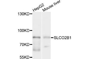 Western blot analysis of extracts of various cell lines, using SLCO2B1 antibody (ABIN6003779) at 1/1000 dilution. (SLCO2B1 抗体)