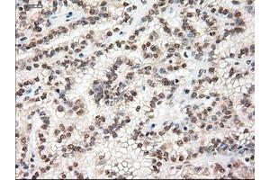 Image no. 10 for anti-Myc Proto-Oncogene protein (MYC) antibody (ABIN1497011) (c-MYC 抗体)