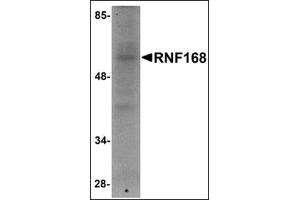 Western blot analysis of RNF168 in human brain tissue lysate with this product at 1 μg/ml. (RNF168 抗体  (C-Term))