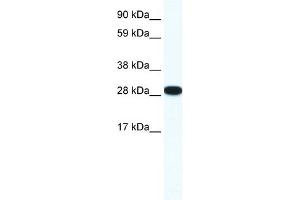 WB Suggested Anti-ZFP36L1 Antibody Titration: 0. (ZFP36L1 抗体  (N-Term))