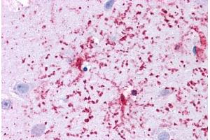 Human Brain, Cortex: Formalin-Fixed, Paraffin-Embedded (FFPE) (GLUD1 抗体  (AA 182-231))