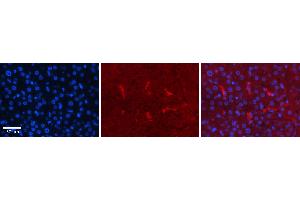 Rabbit Anti-CDK2 Antibody Catalog Number: ARP30331_P050 Formalin Fixed Paraffin Embedded Tissue: Human Liver Tissue Observed Staining: Cytoplasm in Kupffer cells Primary Antibody Concentration: 1:100 Other Working Concentrations: N/A Secondary Antibody: Donkey anti-Rabbit-Cy3 Secondary Antibody Concentration: 1:200 Magnification: 20X Exposure Time: 0. (CDK2 抗体  (Middle Region))
