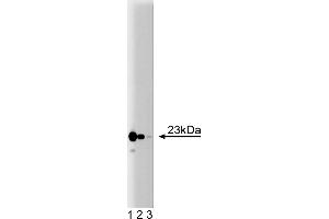 Western Blotting (WB) image for anti-Translocase of Inner Mitochondrial Membrane 23 Homolog (Yeast) (TIMM23) (AA 5-126) antibody (ABIN968428) (TIMM23 抗体  (AA 5-126))