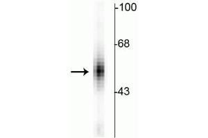 Western blot of human dorsal Raphe nucleus showing specific immunolabeling of the ~55 kDa tryptophan hydroxylase protein. (Tryptophan Hydroxylase 1 抗体)
