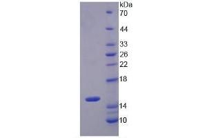 SDS-PAGE (SDS) image for S100 Calcium Binding Protein A8 (S100A8) ELISA Kit (ABIN6574287)