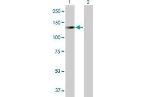 Western Blot analysis of LONP1 expression in transfected 293T cell line by LONP1 MaxPab polyclonal antibody. (LONP1 抗体  (AA 1-959))