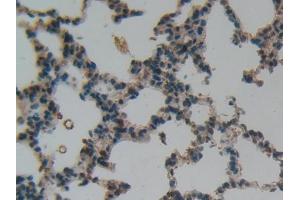 IHC-P analysis of Rat Lung Tissue, with DAB staining. (LIFR 抗体  (AA 642-791))
