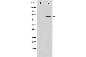 Western blot analysis of SYK phosphorylation expression in HT29 whole cell lysates,The lane on the left is treated with the antigen-specific peptide.