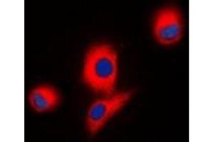 Immunofluorescent analysis of ICK staining in HEK293T cells.