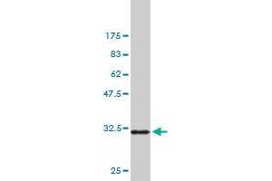 Western Blotting (WB) image for anti-P21-Activated Kinase 1 (PAK1) (AA 191-280) antibody (ABIN562102)