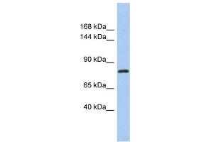 WB Suggested Anti-KLHL32 Antibody Titration: 0. (KLHL32 抗体  (Middle Region))