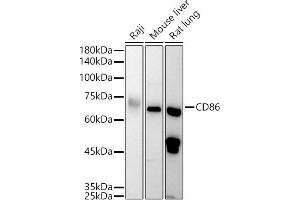Western Blotting (WB) image for anti-CD86 (CD86) (AA 30-247) antibody (ABIN3021701)
