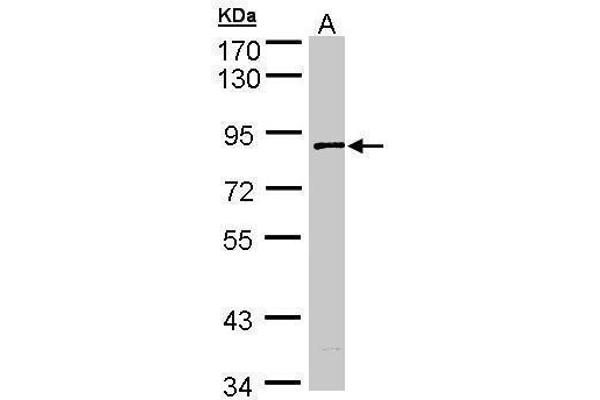 SCYL3 antibody  (Center)