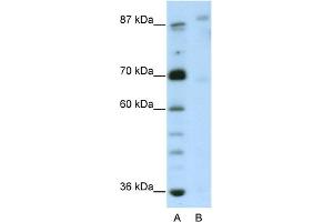 WB Suggested Anti-GLIS3 Antibody Titration:  2. (GLIS3 抗体  (N-Term))