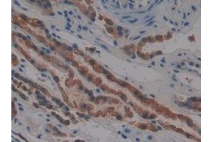 Detection of CK4 in Human Kidney Tissue using Polyclonal Antibody to Cytokeratin 4 (CK4)