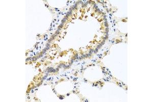 Immunohistochemistry of paraffin-embedded rat lung using CPA1 antibody. (CPA1 抗体)