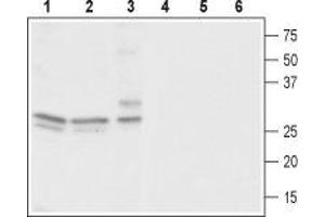 Western blot analysis of rat brain (lanes 1 and 4), mouse brain (lanes 2 and 5) and human neuroblastoma (SH-SY5Y) cells (lanes 3 and 6): - 1-3.