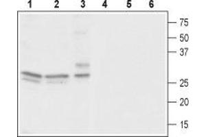 Western blot analysis of rat brain (lanes 1 and 4), mouse brain (lanes 2 and 5) and human neuroblastoma (SH-SY5Y) cells (lanes 3 and 6): - 1-3. (CACNG3 抗体  (C-Term, Intracellular))