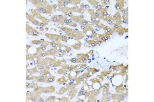 Immunohistochemistry of paraffin-embedded human liver injury using NDUFS3 antibody at dilution of 1:100 (x40 lens). (NDUFS3 抗体)