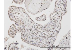 Immunoperoxidase of monoclonal antibody to ATF1 on formalin-fixed paraffin-embedded human placenta. (AFT1 抗体  (AA 1-271))