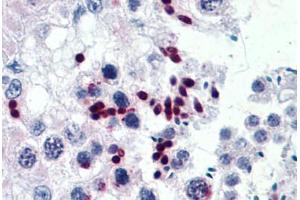 Human Testis: Formalin-Fixed, Paraffin-Embedded (FFPE) (CGGBP1 抗体  (AA 58-168))
