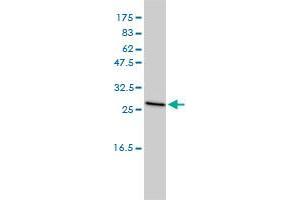 CLTB monoclonal antibody (M01), clone 4B12-1E3 Western Blot analysis of CLTB expression in MCF-7 .
