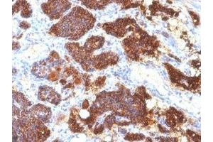 Formalin-fixed, paraffin-embedded human parathyroid stained with PTH antibody (PTH/1175). (PTH 抗体  (AA 32-115))