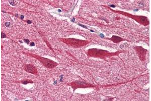 Human Brain, Cortex (formalin-fixed, paraffin-embedded) stained with STX2 antibody ABIN351556 at 5 ug/ml followed by biotinylated goat anti-rabbit IgG secondary antibody ABIN481713, alkaline phosphatase-streptavidin and chromogen. (STX2 抗体  (AA 1-19))