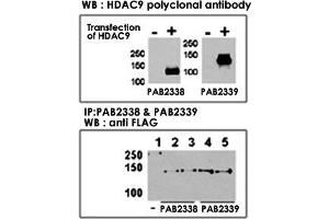 Both anti-HDAC9 N-term  and C-term  polyclonal antibody were tested by WB and IP-WB using HeLa and HeLa-HDAC9 transfected cells. (HDAC9 抗体  (C-Term))